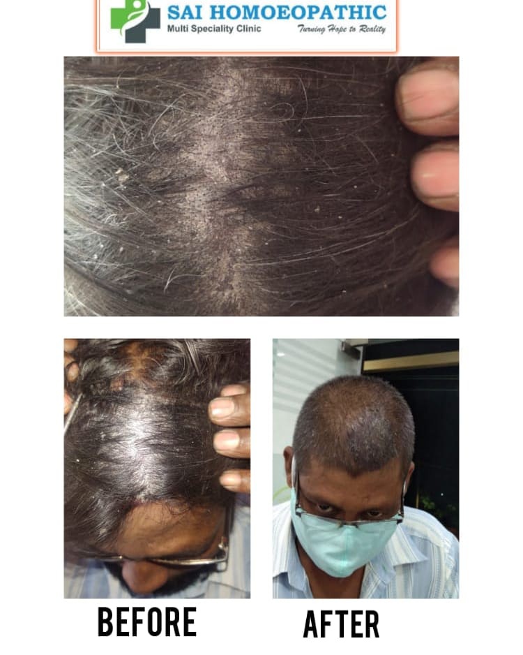 before-1